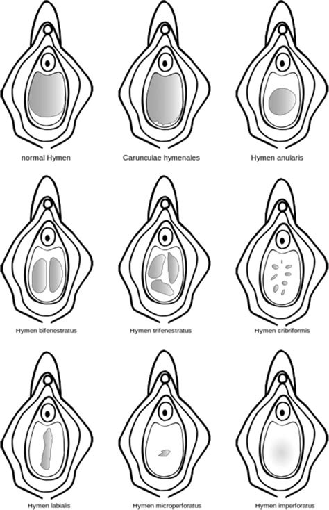 The little tissue that couldn’t – dispelling myths about the Hymen’s .